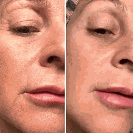 Pure Collagen Mask (4 st) RITUEL