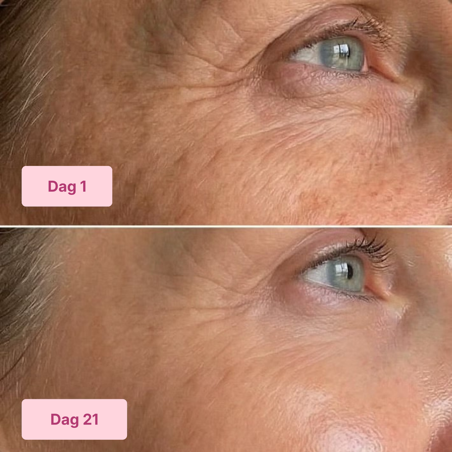 5-Step Anti Aging Kit