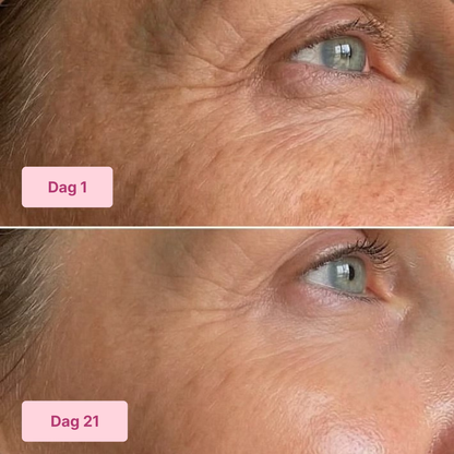 5-Step Anti Aging Kit